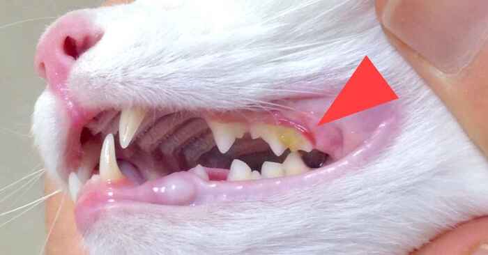Cao răng có thể dễ dàng nhìn thấy trên bề mặt răng và xuất hiện dưới dạng cặn cứng màu kem/vàng hoặc nâu